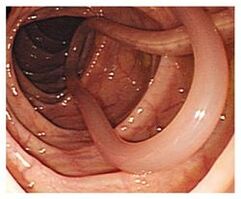 paraisítí i gcorp an duine