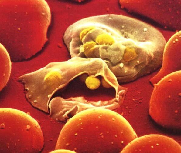an plasmodium maláire parasite is simplí