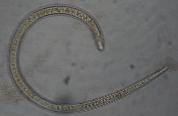 Is péist seadánach bhabhta protostome é Trichinella